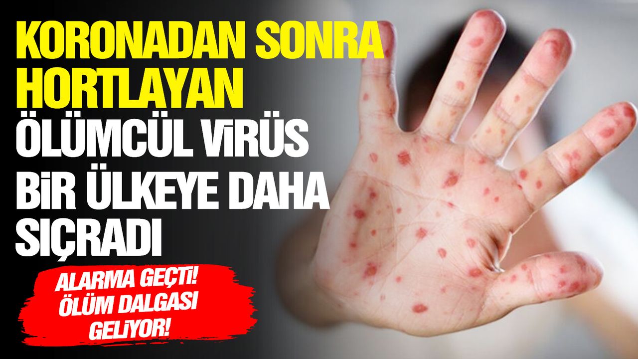 Ölümcül virüs bir ülkeye daha sıçradı!