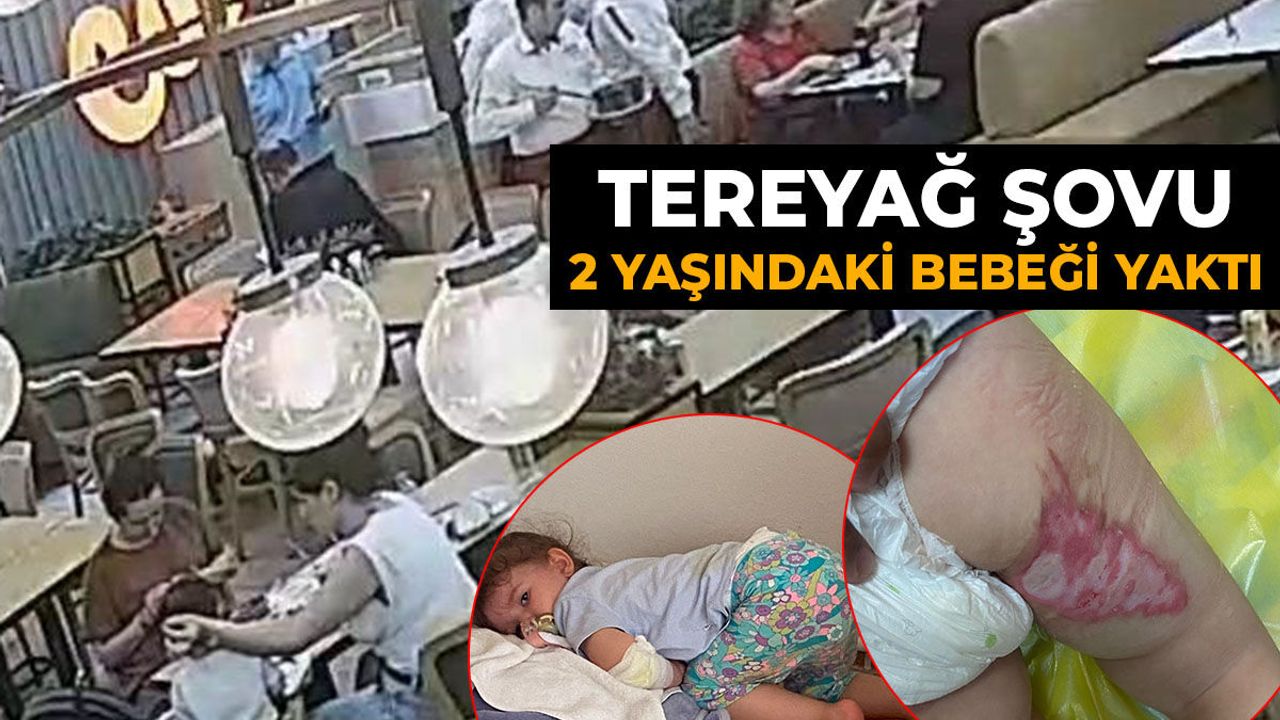 Tereyağı şovu 2 yaşındaki bebeği yaktı