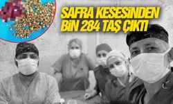 76 yaşındaki hastanın safra kesesinden bin 284 taş çıktı