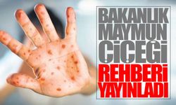 Sağlık Bakanlığı'ndan 'maymun çiçeği' rehberi