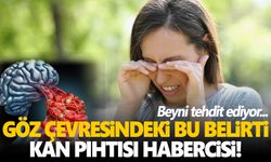 Dikkat! Göz çevresindeki bu belirti kan pıhtısı habercisi