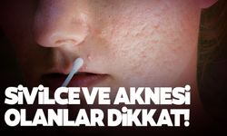 Uzmanlardan sivilce ve aknelere karşı arı zehri ve propolis önerisi