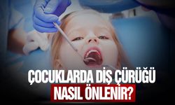 Okul çağındaki çocukların yüzde 60-90’ında diş çürüğü görülüyor