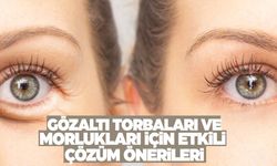 Gözaltı torbaları ve morlukları nasıl geçer? Etkili çözümleri uzmanları açıkladı