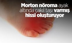 Morton nöroma ayak altında çakıl taşı varmış hissi oluşturuyor