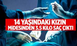 Kayseri’de 14 yaşındaki kızın midesinden tam 3.5 kilo saç çıktı!