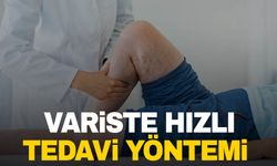 Uzmanı açıkladı! Variste hızlı tedavi yöntemi