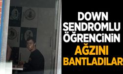 Böyle vicdansızlık görülmedi! Down sendromlu öğrencinin ağzını bantladılar