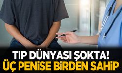 Doktorlar şokta! 78 yaşındaki adam üç penise sahip