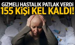 Gizemli hastalık patlak verdi! 155 kişi kel kaldı...