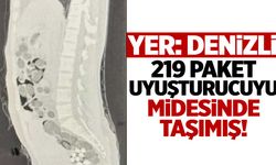 Yer: Denizli! Midesinden 219 paket uyuşturucu çıktı!