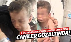 2 yaşındaki bebeği hastanelik eden caniler gözaltında! Yakmaya çalışmışlar…