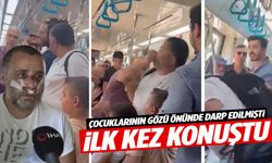 Çocuklarının gözü önünde darp edilen baba sessizliğini bozdu!
