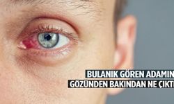 Bulanık gören adamın gözünden bakın ne çıktı! Doktorlar bile inanamadı…