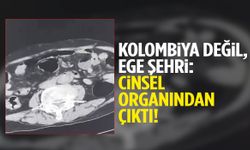 Kolombiya değil, Ege şehri: Cinsel organından çıktı