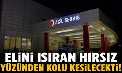 Elini ısıran hırsız yüzünden kolu kesilecekti!