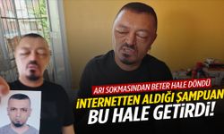 Berber tavsiyesiyle internetten aldığı şampuan kabusu oldu!