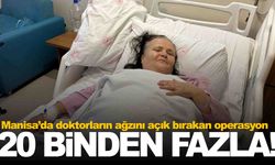 Manisa’da doktorların ağzını açık bırakan operasyon... 20 binden fazla...
