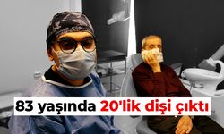 83 yaşında 20'lik dişi çıktı!