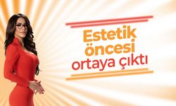 Ela Rümeysa Cebeci'nin eski hali gündem oldu: Estetikten önceki görüntüleri ortaya çıktı