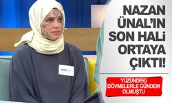 Yüzündeki dövmelerle tanınan Nazan Ünal’ın son hali ortaya çıktı