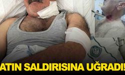 Korkunç olay... At, sahibini boğazından ısırdı!