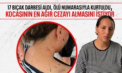 Kocasından 17 bıçak darbesi alan kadın ölü taklidi yaparak kurtuldu!