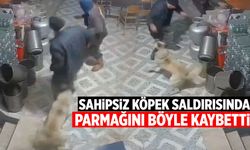 Sahipsiz köpek saldırısında parmağını böyle kaybetti