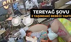 Tereyağı şovu 2 yaşındaki bebeği yaktı