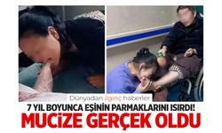 7 yıl boyunca eşinin parmaklarını ısırarak mucizeye neden oldu