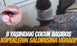 8 yaşındaki çocuk başıboş köpeklerin saldırısına uğradı!