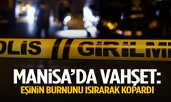 Manisa’da karısının burnunu ısırarak kopardı!