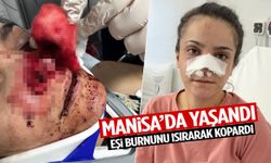 Manisa’da yaşandı… Eşi burnunu ısırarak kopardı!