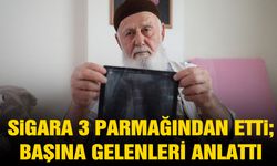 Sigara 3 parmağından etti!