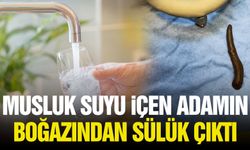 Musluk suyu içen adamın boğazından sülük çıktı