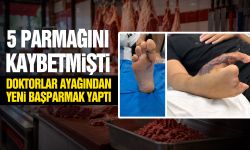 5 parmağını kaybetmişti! Doktorlar ayağından yeni başparmak yaptı