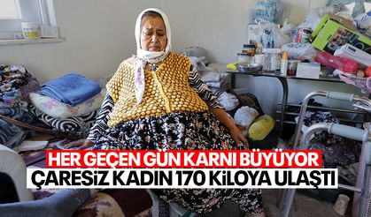 15 yıldır her gün karnı büyüyen çaresiz kadın 170 kiloya ulaştı
