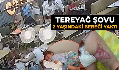 Tereyağı şovu 2 yaşındaki bebeği yaktı