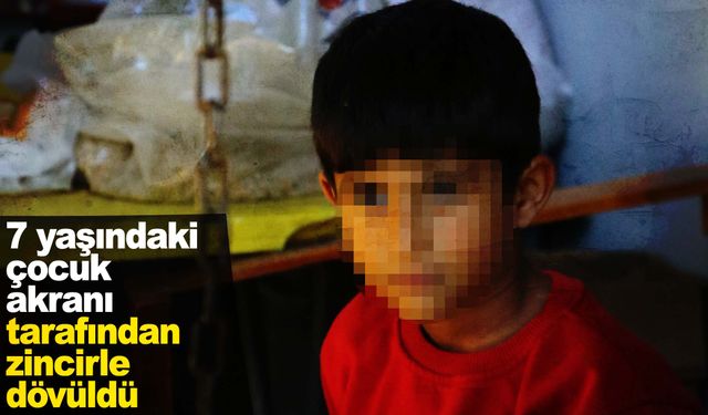 Akran şiddeti durmuyor… 7 yaşındaki çocuk akranını okulda zincirle dövdü   