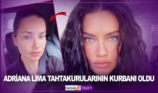 Adriana Lima tahtakurularının kurbanı oldu