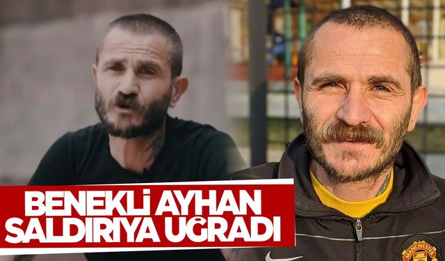 Benekli Ayhan olarak biliniyordu… Saldırıya uğradı!