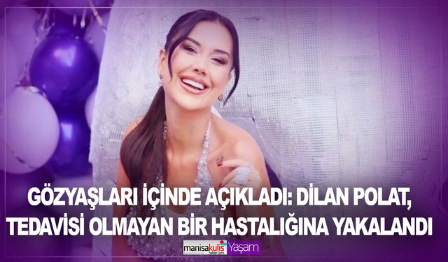 Gözyaşları içinde açıkladı: Dilan Polat, tedavisi olmayan Lupus (Kelebek) hastalığına yakalandı