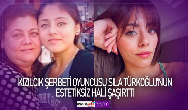 Kızılcık Şerbeti oyuncusu Sıla Türkoğlu’nun eski hali şaşırttı