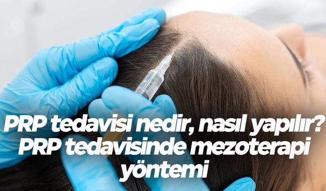 PRP tedavisi nedir, nasıl yapılır? PRP tedavisinde mezoterapi yöntemi