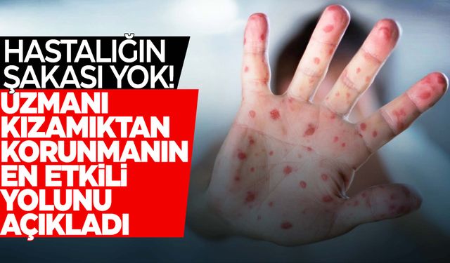 Uzmanı kızamıktan korunmanın en etkili yöntemini açıkladı