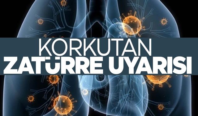 Korkutan zatürre uyarısı! Ölümcül…