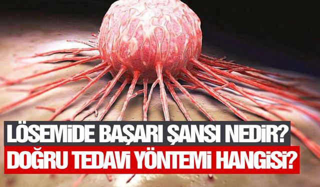 Lösemi nasıl tedavi edilir, doğru tedavi yöntemi nedir?