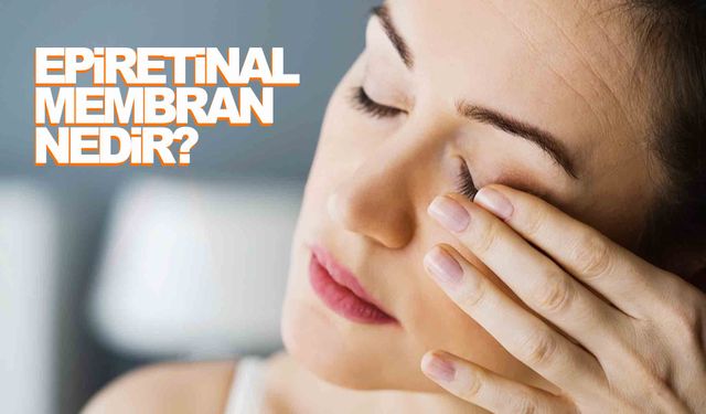 Epiretinal Membran (gözde zar oluşması) nedir?