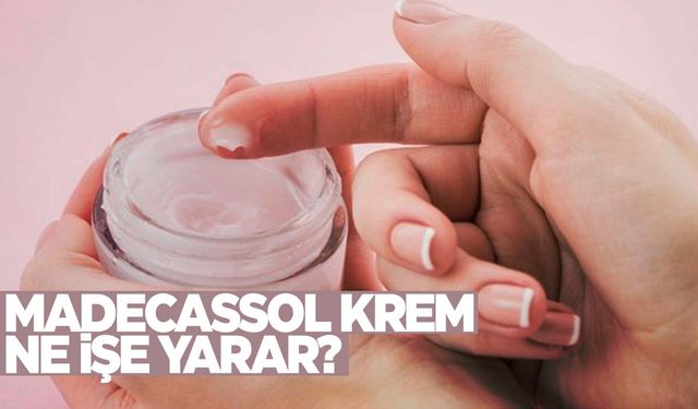 Madecassol krem ne işe yarar? Nerelere sürülür?