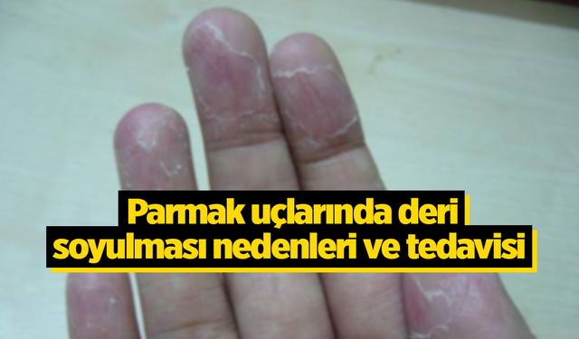 Parmak uçlarında deri soyulmasının nedenleri ve tedavisi